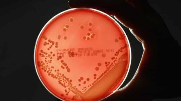 Aparece y enciende alarma una bacteria “come carne” que se transmite mediante el s3x0